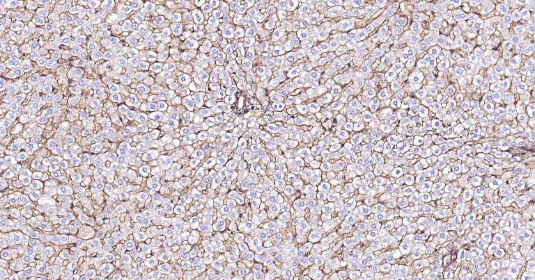 Sodium Potassium ATPase Ready-To-Use IHC Kit (免疫组化试剂盒) | Bioss
